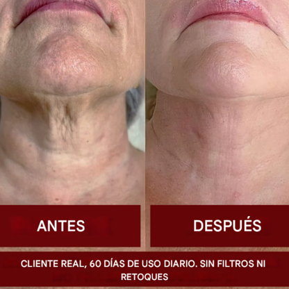 Zooone™ NAD+ 1000mg