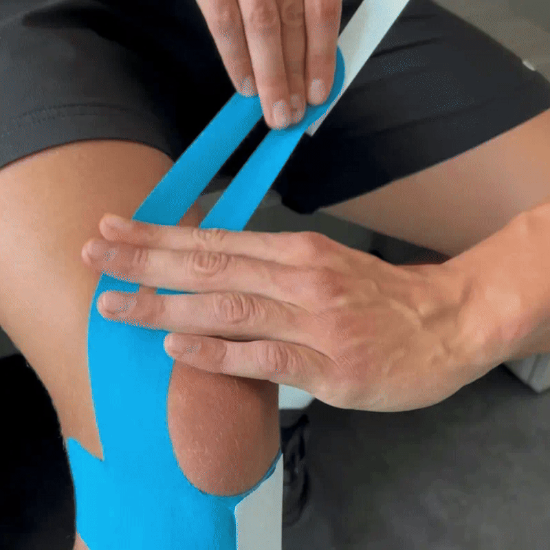 TAPEX™ - Articulación de la rodilla